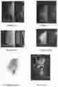 Fig. 28 - System and method for the visualization and characterization of objects in images