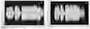 Fig. 01 - Speaker diaphragm and speaker