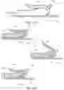 Fig. 30 - Closure devices including incremental release mechanisms and methods therefor