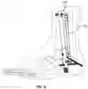 Fig. 08 - Arthrodesis devices for generating and applying compression within joints