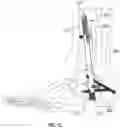 Fig. 11 - Arthrodesis devices for generating and applying compression within joints