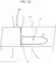 Fig. 20 - Bone fixation device and method of use