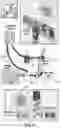 Fig. 07 - BLOOD CLEANSING SYSTEM
