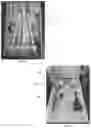 Fig. 05 - SYSTEM AND METHOD FOR A THERAPEUTIC BOX