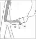 Fig. 01 - METHOD FOR COLLECTING TISSUE IN BILE DUCT