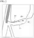 Fig. 02 - METHOD FOR COLLECTING TISSUE IN BILE DUCT