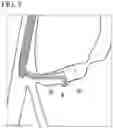 Fig. 06 - METHOD FOR COLLECTING TISSUE IN BILE DUCT