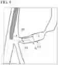 Fig. 09 - METHOD FOR COLLECTING TISSUE IN BILE DUCT