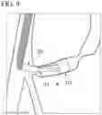 Fig. 10 - METHOD FOR COLLECTING TISSUE IN BILE DUCT