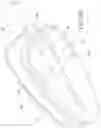 Fig. 08 - Catheter housing