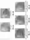 Fig. 06 - METHODS AND COMPOSITIONS FOR ASSESSING CRISPR/CAS-MEDIATED DISRUPTION OR EXCISION AND CRISPR/CAS-INDUCED RECOMBINATION WITH AN EXOGENOUS DONOR NUCLEIC ACID IN VIVO