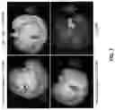 Fig. 09 - METHODS AND COMPOSITIONS FOR ASSESSING CRISPR/CAS-MEDIATED DISRUPTION OR EXCISION AND CRISPR/CAS-INDUCED RECOMBINATION WITH AN EXOGENOUS DONOR NUCLEIC ACID IN VIVO