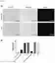 Fig. 14 - Glycosylation of proteins