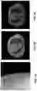 Fig. 06 - Methods of image reconstruction to reduce artifacts in rapid CBCT scans
