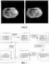 Fig. 07 - Methods of image reconstruction to reduce artifacts in rapid CBCT scans