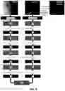 Fig. 08 - Methods of image reconstruction to reduce artifacts in rapid CBCT scans
