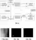 Fig. 09 - Methods of image reconstruction to reduce artifacts in rapid CBCT scans