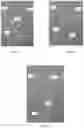 Fig. 03 - JIGS FOR USE IN MEDICAL IMAGING AND METHODS FOR USING THEREOF