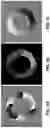 Fig. 07 - Systems and methods for phase unwrapping for dense MRI using deep learning