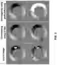 Fig. 08 - Systems and methods for phase unwrapping for dense MRI using deep learning