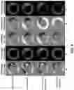 Fig. 09 - Systems and methods for phase unwrapping for dense MRI using deep learning
