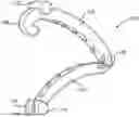 Fig. 01 - Clip cartridge