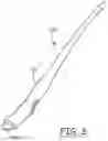 Fig. 03 - Subcutaneous delivery tool