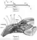 Fig. 02 - Ocular implant