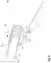 Fig. 13 - Limb holder allowing distal actuation along non-linear paths of actuation