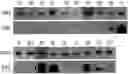 Fig. 01 - Pharmaceutical Composition Comprising Compound Capable of Penetrating Blood-Brain Barrier as Effective Ingredient for Preventing or Treating Brain Cancer