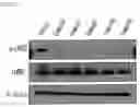 Fig. 08 - Pharmaceutical Composition Comprising Compound Capable of Penetrating Blood-Brain Barrier as Effective Ingredient for Preventing or Treating Brain Cancer