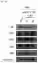 Fig. 22 - Pharmaceutical Composition Comprising Compound Capable of Penetrating Blood-Brain Barrier as Effective Ingredient for Preventing or Treating Brain Cancer