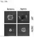 Fig. 23 - Pharmaceutical Composition Comprising Compound Capable of Penetrating Blood-Brain Barrier as Effective Ingredient for Preventing or Treating Brain Cancer