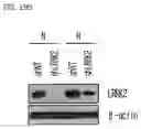 Fig. 24 - Pharmaceutical Composition Comprising Compound Capable of Penetrating Blood-Brain Barrier as Effective Ingredient for Preventing or Treating Brain Cancer