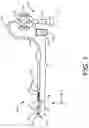 Fig. 02 - Articulated non-destructive testing device having a plurality of actuation systems and a method of articulating the device