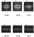 Fig. 07 - Target recognition from SAR data using range profiles and a long short-term memory (LSTM) network