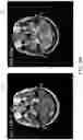 Fig. 07 - Benign tumor development trend assessment system, server computing device thereof and computer readable storage medium