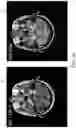 Fig. 08 - Benign tumor development trend assessment system, server computing device thereof and computer readable storage medium