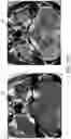Fig. 09 - Benign tumor development trend assessment system, server computing device thereof and computer readable storage medium