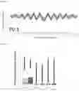 Fig. 05 - TRANSCRIPTION FACTOR PROFILING