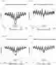 Fig. 37 - TRANSCRIPTION FACTOR PROFILING
