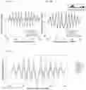 Fig. 62 - TRANSCRIPTION FACTOR PROFILING