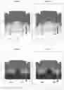 Fig. 07 - Manufacturing method of semiconductor device using gate-through implantation