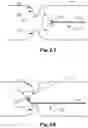 Fig. 02 - Method and Apparatus for Detecting Missed Areas during Endoscopy