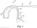 Fig. 02 - HEARING DEVICE INCLUDING IMAGE SENSOR