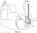 Fig. 15 - Treatment planning
