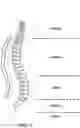 Fig. 02 - Back support frame