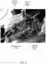 Fig. 10 - Bicycle helmet warning system