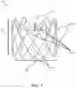 Fig. 02 - Prosthetic heart valve delivery system