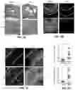Fig. 02 - COMPOSITIONS AND METHODS FOR THE TREATMENT OF DEMYELINATING CONDITIONS